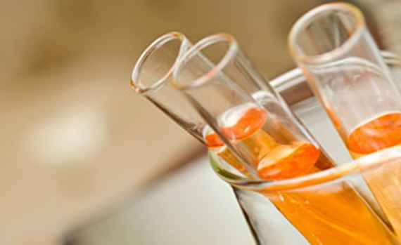 Foto Laborröhrchen mit oranger Flüssigkeit